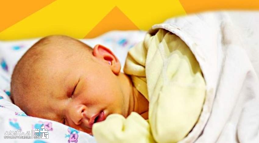 درمان زردی نوزاد | نفت آنلاین