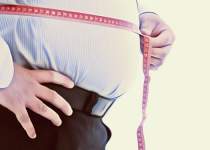 چه افرادی باید جراحی «چاقی» انجام دهند؟ | نفت آنلاین
